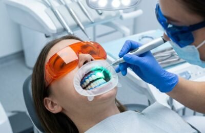 Laser-Assisted Tooth Bleaching: Optical Physics, Intrapulpal Thermal Thresholds, and Enamel Preservation