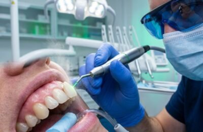 Erbium Laser Debonding of Ceramic Veneers and Orthodontic Brackets: Photothermal Mechanisms
